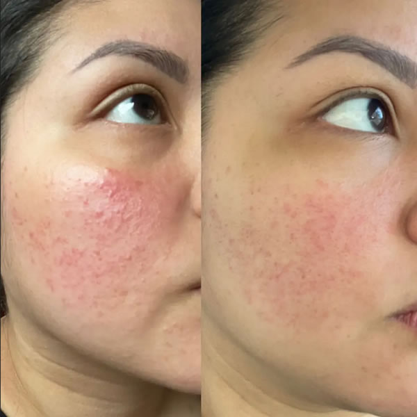 Beef Tallow Face Cream