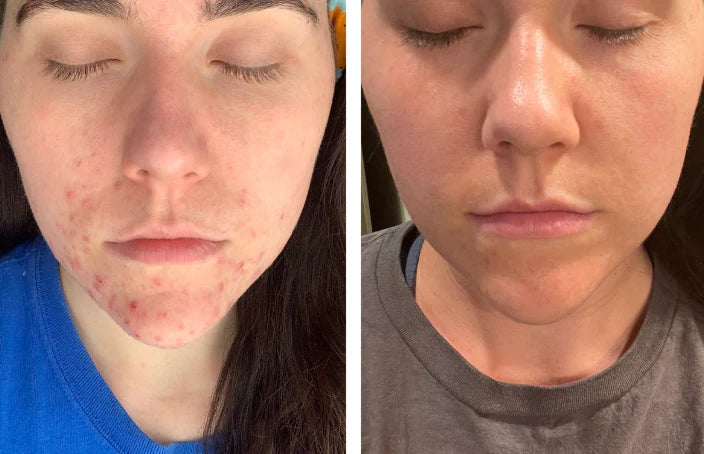 Beef Tallow Face Cream